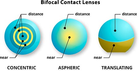 Bifocal Contact Lenses NYC Eye Doctor