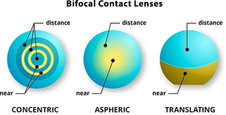 Contact Lenses color Multifocal Bifocal Contacts Top Eye Doctor NYC