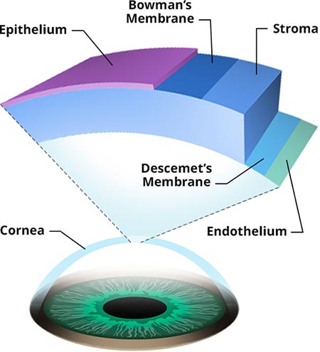 Corneal Dystrophy | NYC Eye Doctor