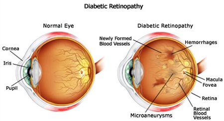 Retina: Anatomy, Function & Common Conditions