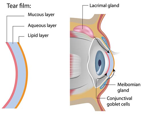 Dry Eyes Treatment · NYC Eye Doctor