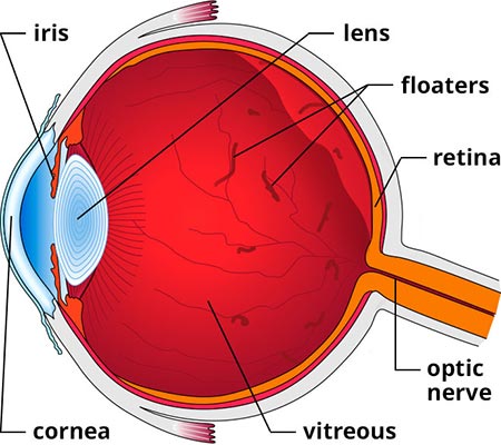 Eye Floaters, Spots - Treatment NYC