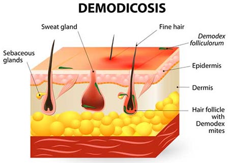 Infected Eyelash Treatment NYC